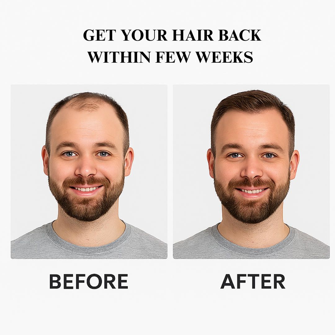 RootRevive - Hair Growth Roll on Serum