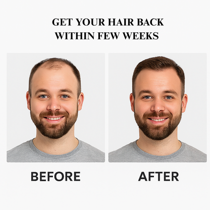 RootRevive - Hair Growth Roll on Serum